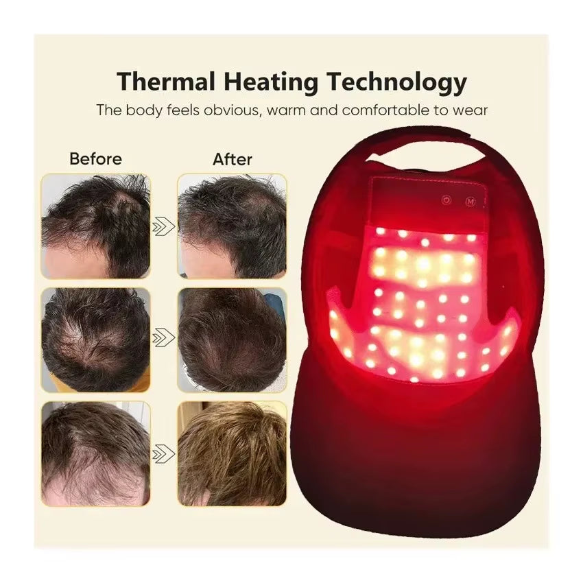 Red&Infrared Light Therapy Device for Hair Fast Growth Cap Red Light Therapy for Hair Loss Treatment with USB Charging Anti-Hair
